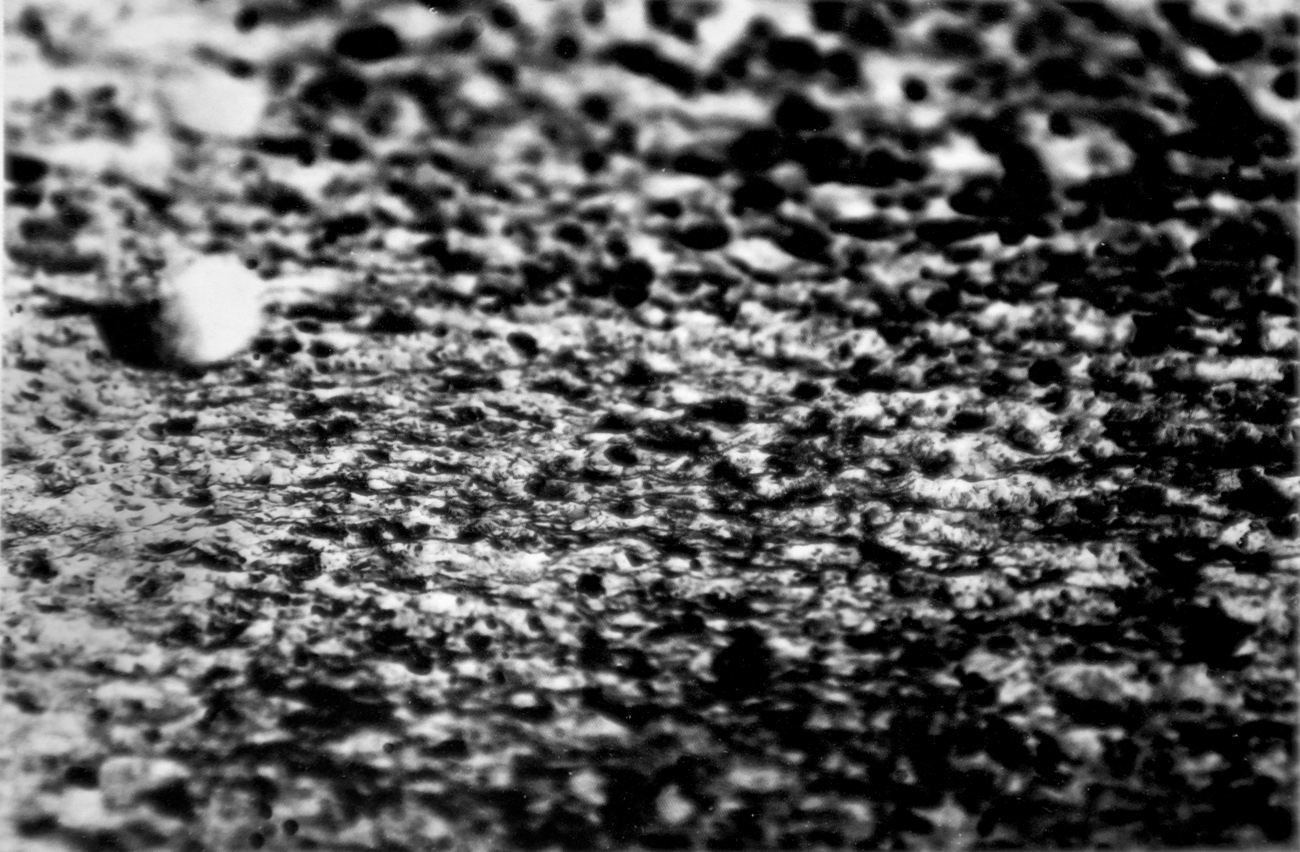 Eβης Xαλκίδου